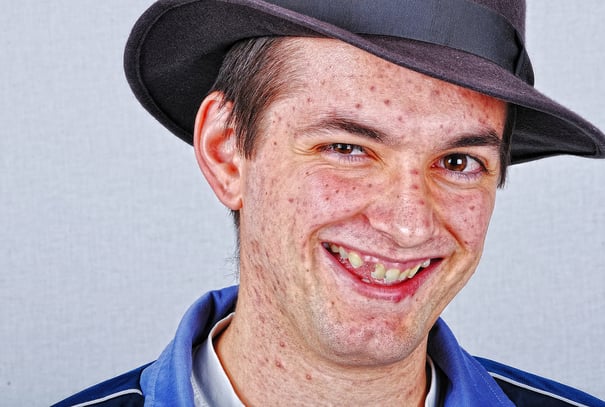 Young funny man with many acne on face smiling